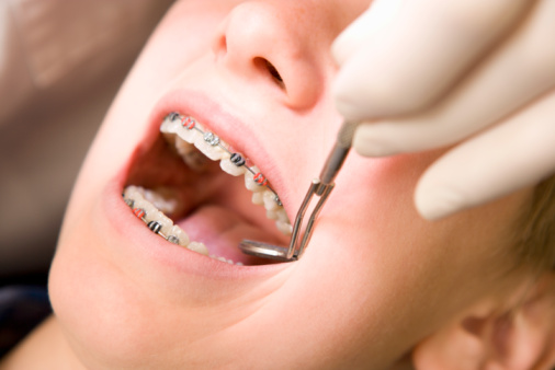orthodontic